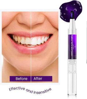 Lanthome - V34 Teeth Whitening Pen