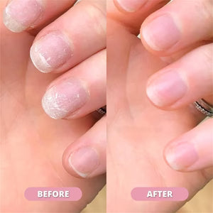 Radiant Nail Growth Oil Pen
